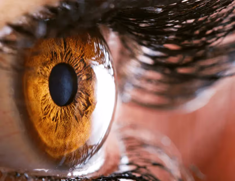 Очите говорят - irisolog.bg Очите говорят - irisolog